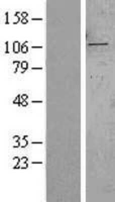 Western Blot: SYTL2 Overexpression Lysate (Adult Normal) [NBL1-16657] Left-Empty vector transfected control cell lysate (HEK293 cell lysate); Right -Over-expression Lysate for SYTL2.