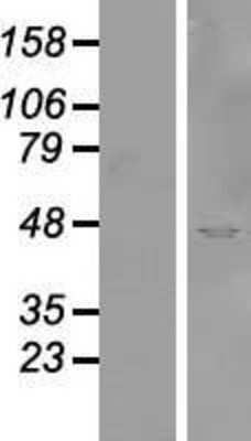 Western Blot: SYTL2 Overexpression Lysate (Adult Normal) [NBP2-09932] Left-Empty vector transfected control cell lysate (HEK293 cell lysate); Right -Over-expression Lysate for SYTL2.