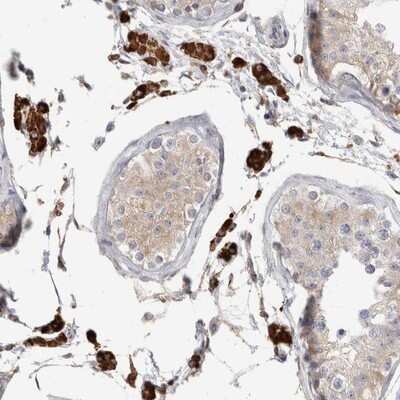 Immunohistochemistry-Paraffin SYTL5 Antibody - BSA Free