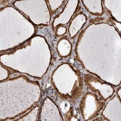 Immunohistochemistry-Paraffin: SZRD1 Antibody [NBP1-85074] - Staining of human thyroid gland shows strong cytoplasmic and nuclear positivity in glandular cells.