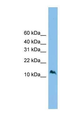 Western Blot: SZRD1 Antibody [NBP1-57737] - RPMI-8226 tissue lysate at a concentration of 1ug/ml.