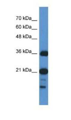 Western Blot: SZRD1 Antibody [NBP1-57737] - HepG2 Cell Lysate at 1.0 ug/ml.  Gel Concentration 10-20%.  ELISA Titer: 1:62500 Positive Control: RPMI 8226 cell lysate.