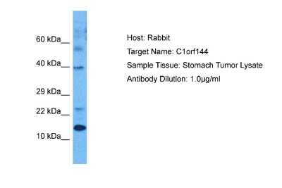 Western Blot: SZRD1 Antibody [NBP2-85865] - Host: Rabbit. Target Name: C1ORF144. Sample Tissue: Human Stomach Tumor. Antibody Dilution: 1.0ug/ml