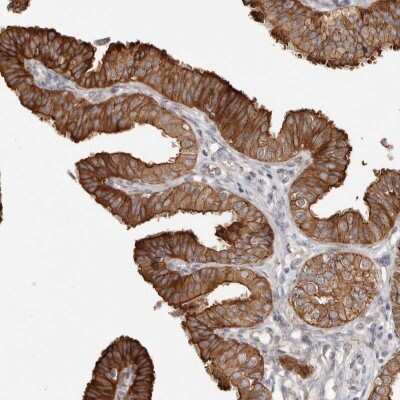 Immunohistochemistry-Paraffin: SZT2 Antibody [NBP1-89886] - Staining of human fallopian tube shows strong cytoplasmic positivity in glandular cells.