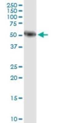 Western Blot: Salivary Amylase Alpha Antibody (2D4) [H00000276-M04] - Analysis of AMY1A expression in human pancreas.