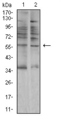 Western Blot: Salivary Amylase Alpha Antibody (5G6F7) [NBP2-61862] - Analysis using AMY1A mouse mAb against A549 (1) and C6 (2) cell lysate.