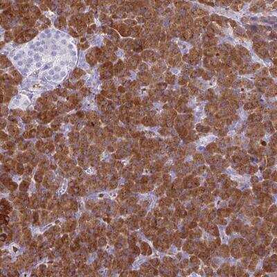 Immunohistochemistry-Paraffin: Salivary Amylase Alpha Antibody [NBP2-46735] - Staining of human pancreas shows strong cytoplasmic positivity in exocrine glandular cells.