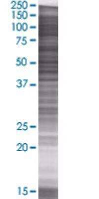 SDS-Page: Salivary Amylase Beta Overexpression Lysate (Denatured) [H00000277-T01] - AMY1B transfected lysate.