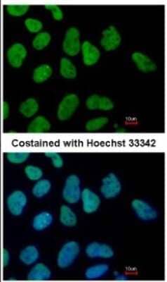 Immunocytochemistry/Immunofluorescence: Sall4 Antibody [NBP1-32969] - Paraformaldehyde-fixed Human ESC, using SALL4 antibody at 1:400 dilution.