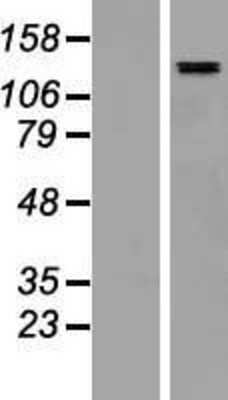 Western Blot SALL4 Overexpression Lysate