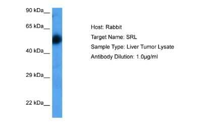 Western Blot: Sarcalumenin Antibody [NBP2-88215] - Host: Rabbit. Target Name: SRL. Sample Tissue: Liver Tumor lysates. Antibody Dilution: 1ug/ml