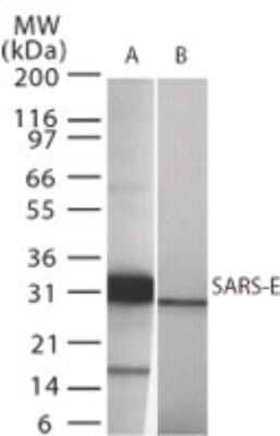 Western Blot: Sars Envelope Protein Antibody [NB100-56562] - analysis of SARS-E in (A) recombinant fusion protein containing amino acids 59-70 and (B) fusion partner without these amino acids, using this antibody.