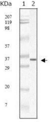 Western Blot: Sars M Antibody (2H2C4) [NBP1-28852] - Western blot analysis using SARS-mpm mouse mAb against SARS-mpm recombinant protein.