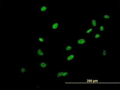 Immunocytochemistry/Immunofluorescence: Scaffold attachment factor B2 Antibody [H00009667-B01P] - Analysis of purified antibody to SAFB2 on HeLa cell. (antibody concentration 10 ug/ml)