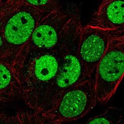 Immunocytochemistry/ Immunofluorescence Scaffold attachment factor B2 Antibody - BSA Free
