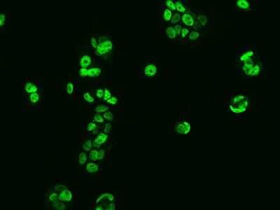 Immunocytochemistry/Immunofluorescence: Scaffold attachment factor B2 Antibody [NBP2-98007] - Immunofluorescence staining of Scaffold attachment factor B2 in MCF7 cells. Cells were fixed with 4% PFA, permeabilzed with 0.1% Triton X-100 in PBS, blocked with 10% serum, and incubated with rabbit anti-Human Scaffold attachment factor B2 polyclonal antibody (dilution ratio 1:200) at 4C overnight. Then cells were stained with the Alexa Fluor(R)488-conjugated Goat Anti-rabbit IgG Secondary antibody (green). Positive staining was localized to Nucleus.
