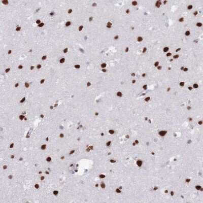 Immunohistochemistry-Paraffin: Scaffold attachment factor B2 Antibody [NBP2-13274] - Staining of human cerebral cortex shows strong nuclear positivity in neuronal cells and glial cells.