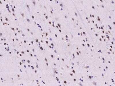 Immunohistochemistry-Paraffin: Scaffold attachment factor B2 Antibody [NBP2-98007] - Immunochemical staining of human Scaffold attachment factor B2 in human brain with rabbit polyclonal antibody at 1:100 dilution, formalin-fixed paraffin embedded sections.
