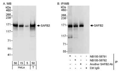 Western Blot: Scaffold attachment factor B2 Antibody [NB100-58791] - Detection of Human SAFB2 on HeLa whole cell lysate using NB100-58791. SAFB2 was also immunoprecipitated by rabbit anti-SAFB2 antibodies NB100-58792 and another SAFB Ab.