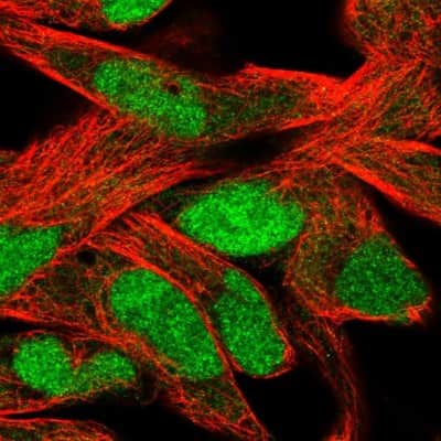 Immunocytochemistry/Immunofluorescence: Schlafen 11 Antibody [NBP2-57084] - Staining of human cell line RH-30 shows localization to nucleus. Antibody staining is shown in green. 
