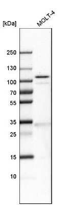 Western Blot: Schlafen 11 Antibody [NBP1-92368] - Analysis in human cell line MOLT-4.