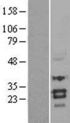 Western Blot: Sclerostin Overexpression Lysate (Adult Normal) [NBL1-16341] Left-Empty vector transfected control cell lysate (HEK293 cell lysate); Right -Over-expression Lysate for Sclerostin.