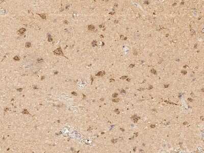 Immunohistochemistry-Paraffin: Scn2b Antibody [NBP3-00207] - Immunochemical staining of human Scn2b in human brain with rabbit polyclonal antibody (1:5000, formalin-fixed paraffin embedded sections).