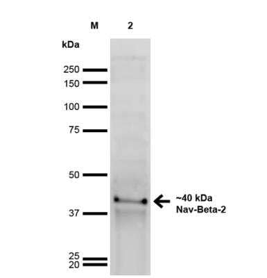 Western Blot: Scn2b Antibody (S395-68) [NBP2-59317] -  Analysis of Rat Brain showing detection of ~40 kDa Nav-Beta-2 protein using Mouse Anti-Nav-Beta-2 Monoclonal Antibody, Clone S395-68. Lane 1: MW Ladder. Lane 2: Rat Brain. Load: 20 ug . Block: 2% GE Healthcare Blocker for 1 hour at RT. Primary Antibody: Mouse Anti-Nav-Beta-2 Monoclonal Antibody at 1:1000 for 16 hours at 4 degrees C. Secondary Antibody: Goat Anti-Mouse IgG: HRP at 1:200 for 1 hour at RT. Color Development: ECL solution for 6 min at RT. Predicted/Observed Size: ~40 kDa.