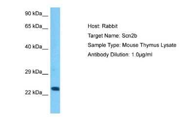 Western Blot Scn2b Antibody - BSA Free