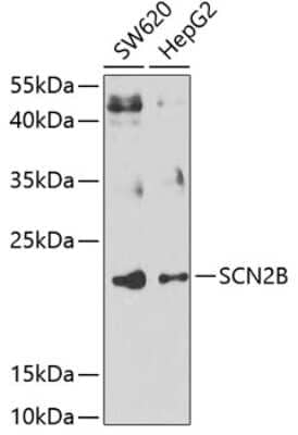 Western Blot Scn2b Antibody - BSA Free