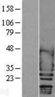 Western Blot: Scn2b Overexpression Lysate (Adult Normal) [NBL1-15742] Left-Empty vector transfected control cell lysate (HEK293 cell lysate); Right -Over-expression Lysate for Scn2b.