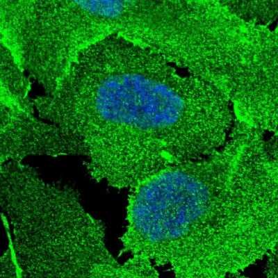 <b>Orthogonal Strategies Validation. </b>Immunocytochemistry/Immunofluorescence: Scribble Antibody [NBP2-47286] - Staining of human cell line U-2 OS shows localization to nucleoplasm, plasma membrane & cell junctions. Antibody staining is shown in green.