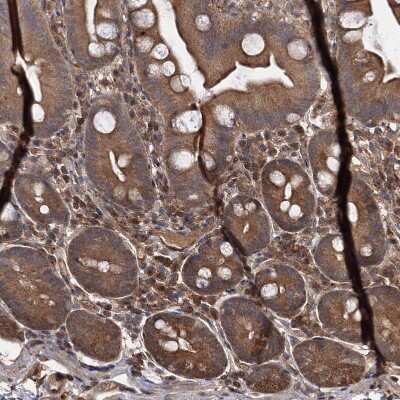 Immunohistochemistry-Paraffin: SeP Antibody [NBP1-80766] - Staining of human gastrointestinal shows moderate cytoplasmic positivity in glandular cells.