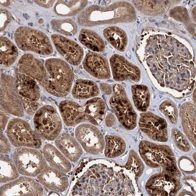 Immunohistochemistry-Paraffin: SeP Antibody [NBP1-80766] - Staining of human kidney shows moderate to strong cytoplasmic positivity in cells in tubules.