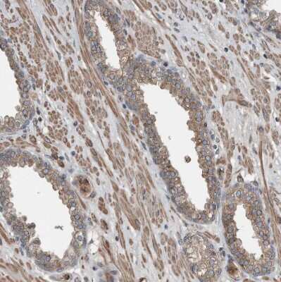 Immunohistochemistry-Paraffin: Sec8 Antibody [NBP1-83944] - Staining of human prostate shows moderate cytoplasmic positivity in smooth muscle cells.