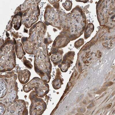 Immunohistochemistry-Paraffin: Sec8 Antibody [NBP1-83944] - Staining of human placenta shows moderate cytoplasmic positivity in trophoblastic cells.