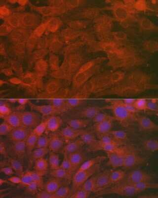 Immunocytochemistry/Immunofluorescence: Secernin-1 Antibody [NBP3-16020] - Immunofluorescence analysis of C6 cells using Secernin-1 Rabbit pAb (NBP3-16020) at dilution of 1:100 (40x lens). Blue: DAPI for nuclear staining.