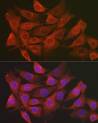 Immunocytochemistry/Immunofluorescence: Secernin-1 Antibody [NBP3-16020] - Immunofluorescence analysis of NIH/3T3 cells using Secernin-1 Rabbit pAb (NBP3-16020) at dilution of 1:100 (40x lens). Blue: DAPI for nuclear staining.