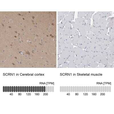 Immunohistochemistry-Paraffin Secernin-1 Antibody