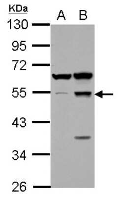 Western Blot: Secernin-1 Antibody [NBP2-20284] - Sample (30 ug of whole cell lysate) A: Neuro2A B: GL261 10% SDS PAGE gel, diluted at 1:1000.