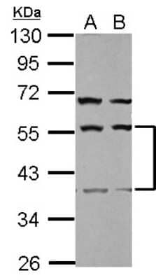 Western Blot: Secernin-1 Antibody [NBP2-20284] - Sample (30 ug of whole cell lysate) A: U87-MG B: SK-N-SH 10% SDS PAGE gel, diluted at 1:1000.