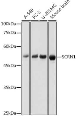 Western Blot: Secernin-1 Antibody [NBP3-16020] - Western blot analysis of extracts of various cell lines, using Secernin-1 antibody (NBP3-16020) at 1:1000 dilution. Secondary antibody: HRP Goat Anti-Rabbit IgG (H+L) at 1:10000 dilution. Lysates/proteins: 25ug per lane. Blocking buffer: 3% nonfat dry milk in TBST. Detection: ECL Basic Kit. Exposure time: 1s.