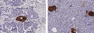 Immunohistochemistry-Paraffin: Secretagogin Antibody (048) [NBP2-90100] - Staining of human SCGN in human pancreas (from 2 donors) with rabbit monoclonal antibody (1:200).