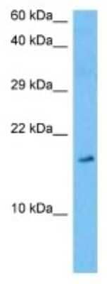 Western Blot: Secretin Antibody [NBP3-10104] - Western blot analysis of Secretin in Rat Thymus lysates. Antibody dilution at 1ug/ml