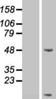 Western Blot: Secretin Overexpression Lysate (Adult Normal) [NBP2-06507] Left-Empty vector transfected control cell lysate (HEK293 cell lysate); Right -Over-expression Lysate for Secretin.