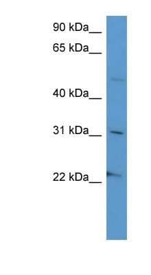 Western Blot: Secretogranin 3 Antibody [NBP1-79762] - HepG2 cell lysate, concentration 0.2-1 ug/ml.