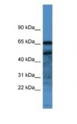 Western Blot: Secretogranin 3 Antibody [NBP1-91632] - Titration: 1.0 ug/ml Positive Control: Mouse Small Intestine.