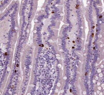 Immunohistochemistry-Paraffin: Secretogranin V Antibody [NBP1-90312] - Staining of human duodenum shows strong cytoplasmic positivity in enteroendocrine cells.