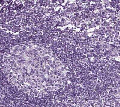 Immunohistochemistry-Paraffin: Secretogranin V Antibody [NBP1-90312] - Staining of human lymph node shows no positivity in germinal center cells and non-germinal center cells as expected.