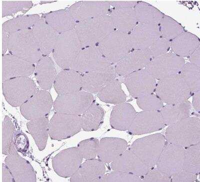 Immunohistochemistry-Paraffin: Secretogranin V Antibody [NBP1-90312] - Staining of human skeletal muscle shows no cytoplasmic positivity in myocytes as expected.